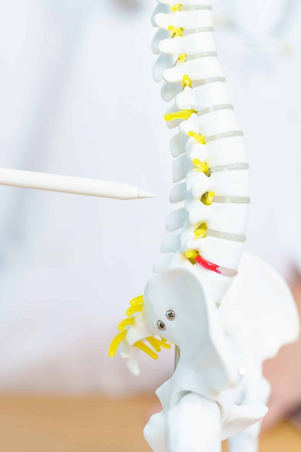 surmonter la discopathie dégénérative c5-c6 : stratégies et solutions pour une meilleure qualité de vie